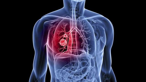 cannabis damage lungs