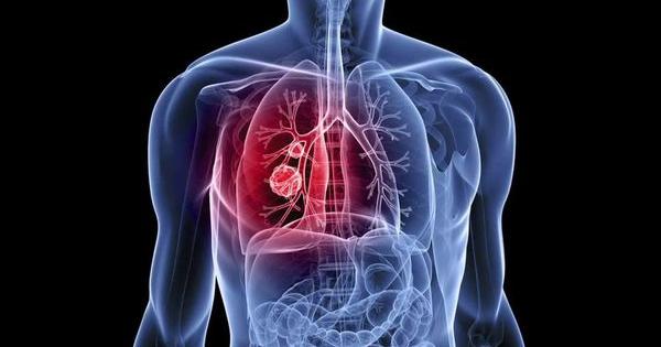 cannabis damage lungs